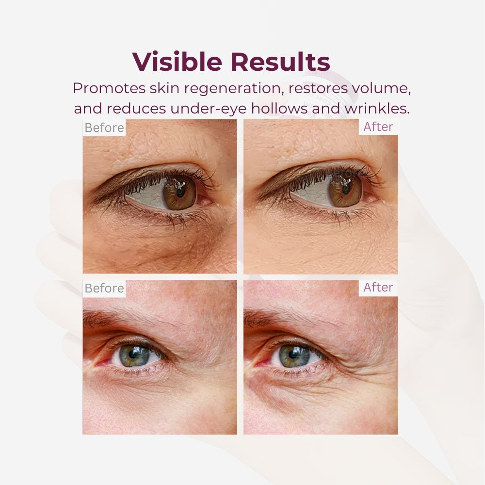 Olvena Calcium Wrinkle Repair Balm